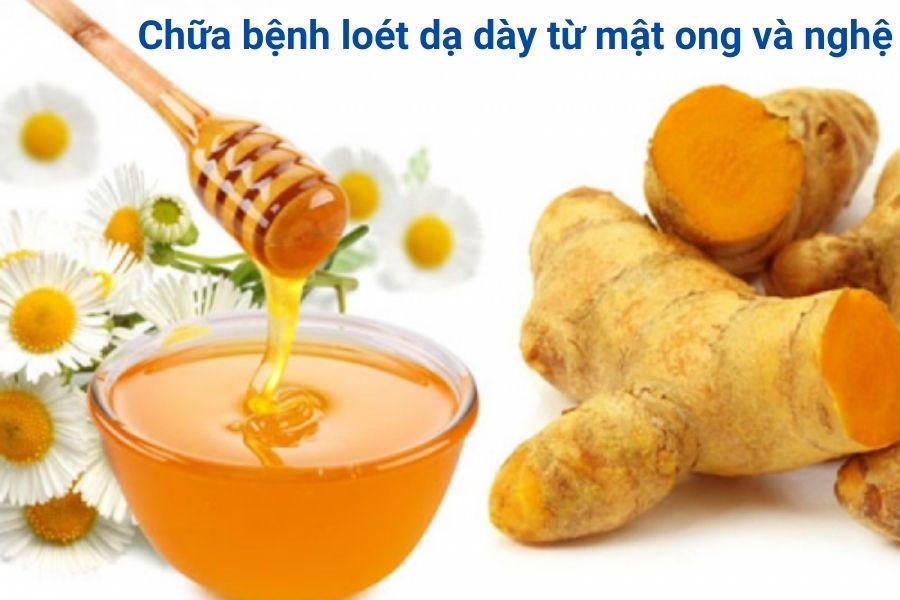 mat-ong-va-nghe