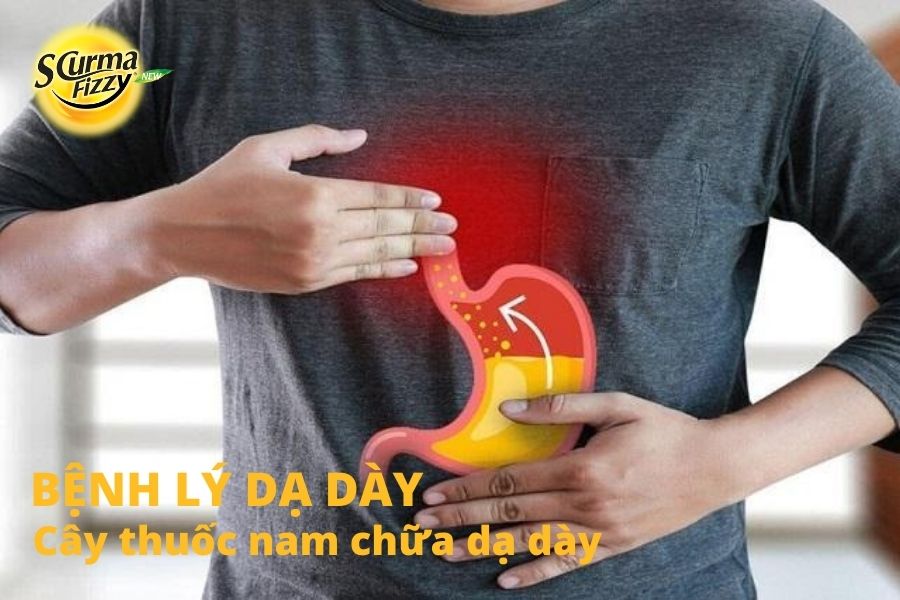 cay-thuoc-nam-chua-da-day-2