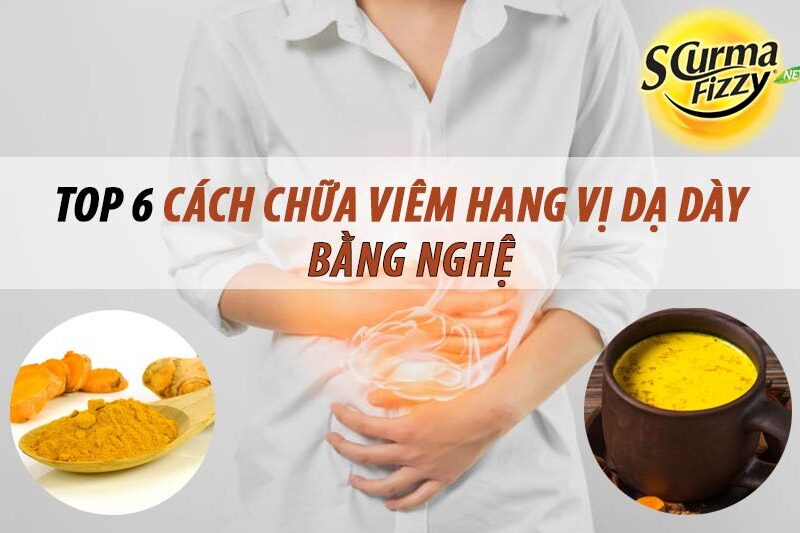 chua-viem-hang-vi-da-day-bang-nghe-6