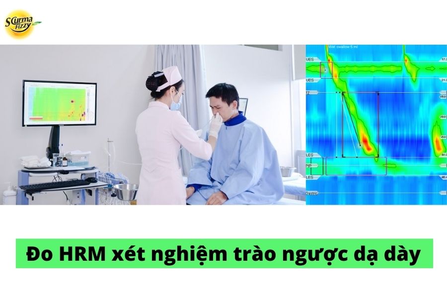 Đo HRM- đo áp lực thực quản