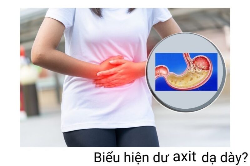 Dư axit dạ dày