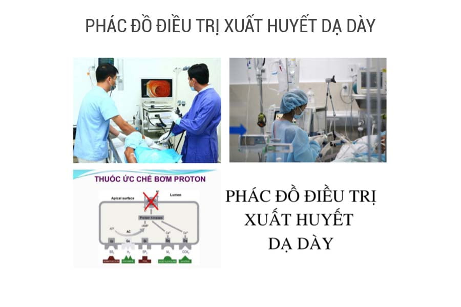 phac-do-dieu-tri-xuat-huyet-da-day6