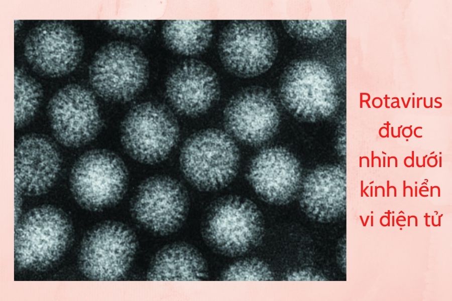 rotavirus-la-nguyen-nhan-chinh-gay-viem-da-day-ruot-cap-o-tre-em