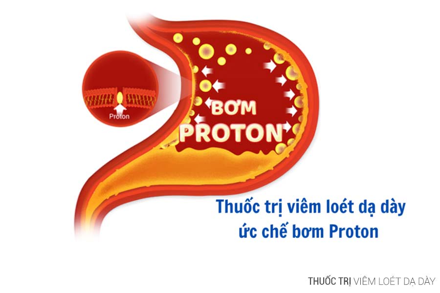 Thuốc ức chế bơm proton