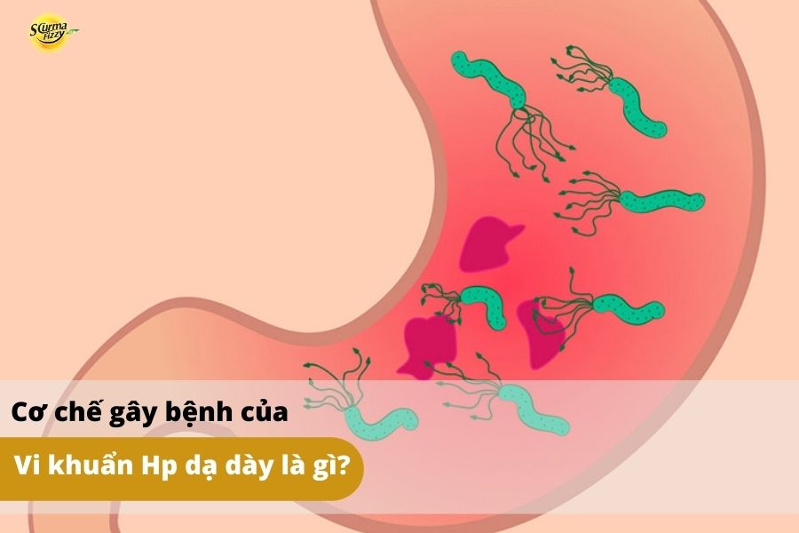 Tại sao vi khuẩn Hp có thể gây bệnh dạ dày