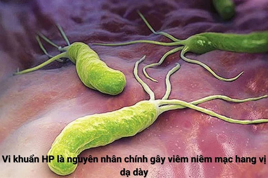 Vi khuẩn Hp