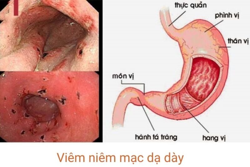 viem-niem-mac-da-day