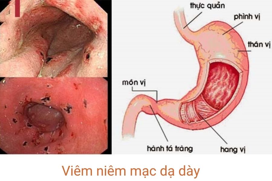 viem-niem-mac-da-day-1