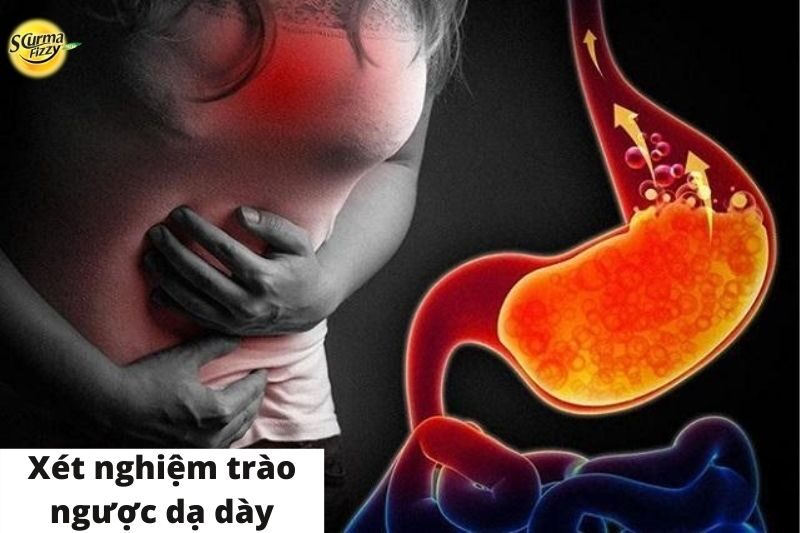 Khi nào cần xét nghiệm trào ngược dạ dày thực quản.