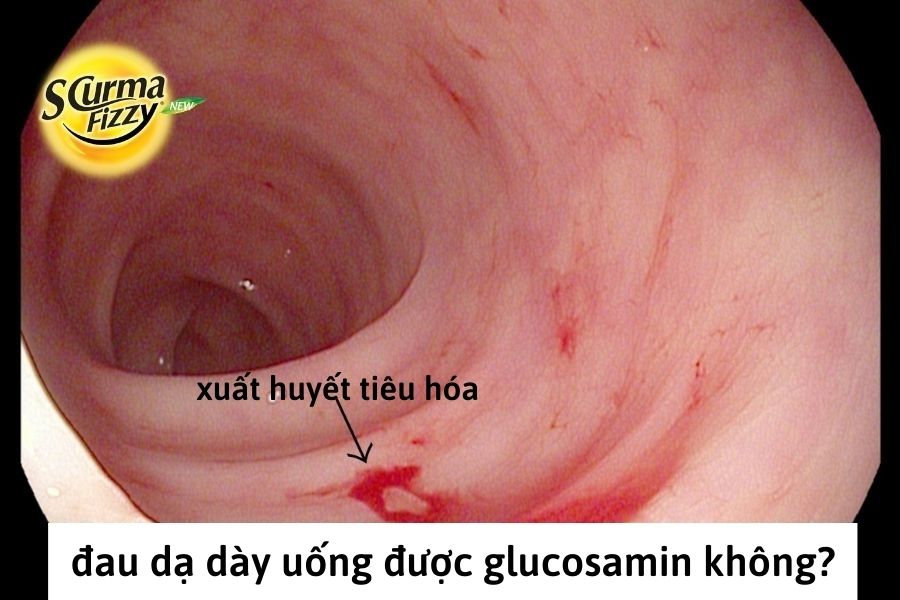 dau-da-day-co-uong-duoc-glucosamin-khong