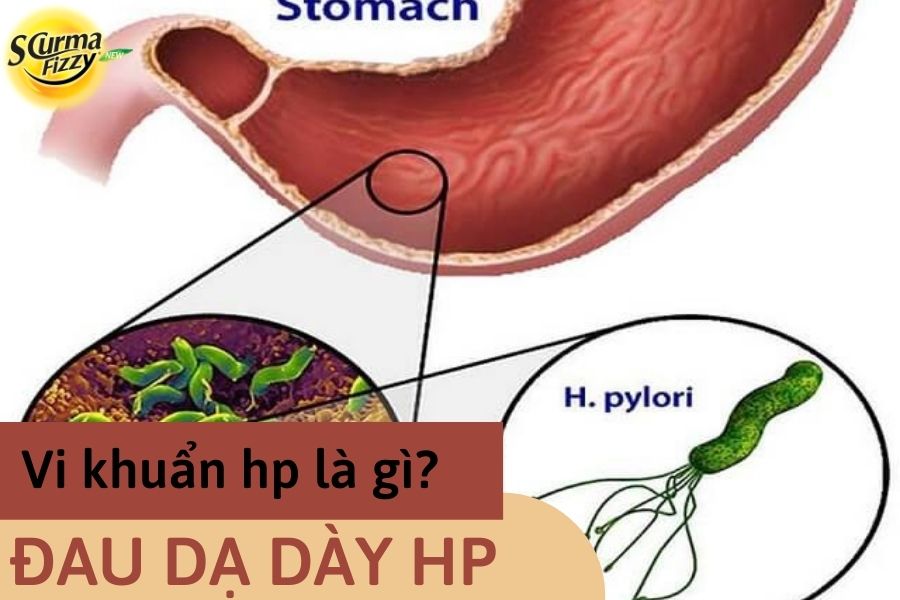 Vi khuẩn hp là gì? Vai trò trong đau da dày hp
