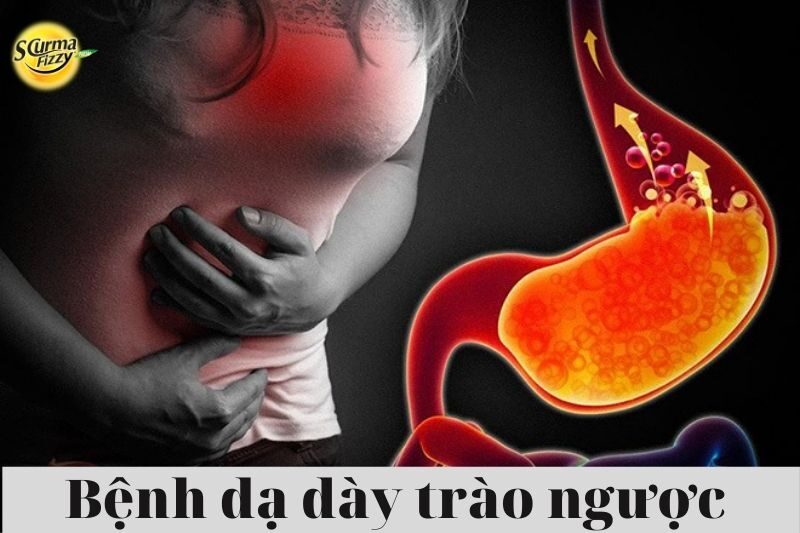 Bệnh dạ dày trào ngược