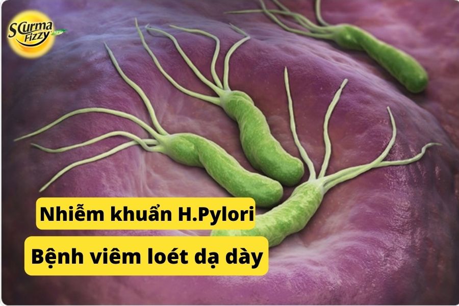 Nhiễm khuẩn H. Pylori