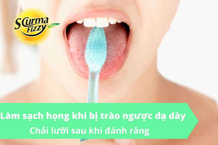 Chải lưỡi sau đánh răng làm sạch họng khi trào ngược dạ dà