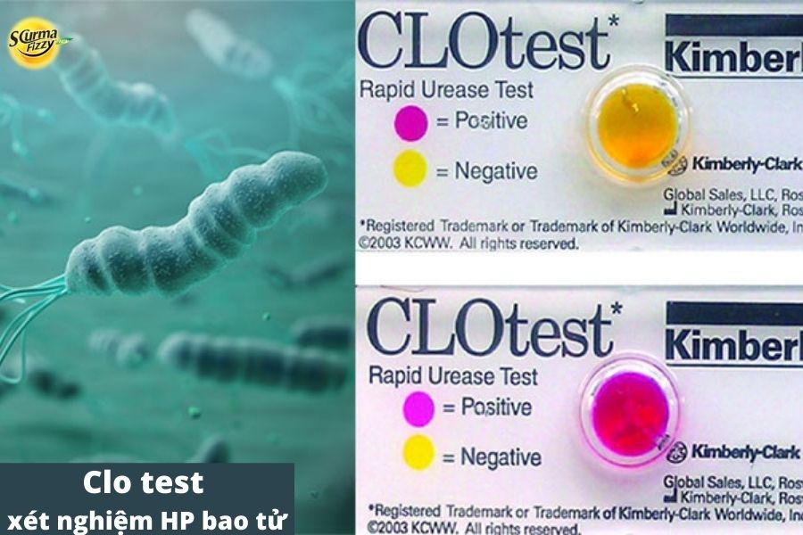 Clo test- xét nghiệm chẩn đoán vi khuẩn HP bao tử