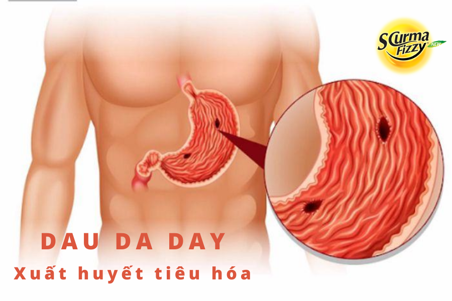 dau-da-day-4