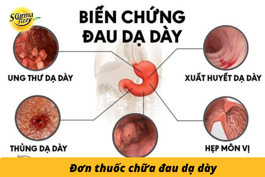 Don-thuoc-chua-dau-da-day-3