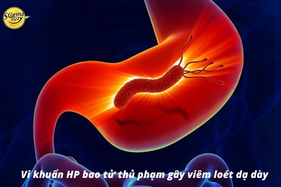 Vi khuẩn HP là một trong những thủ phạm hàng đầu gây bệnh lý viêm loét dạ dày tá tràng