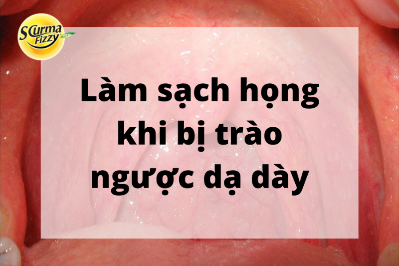 Làm sạch họng khi bị trào ngược dạ dày