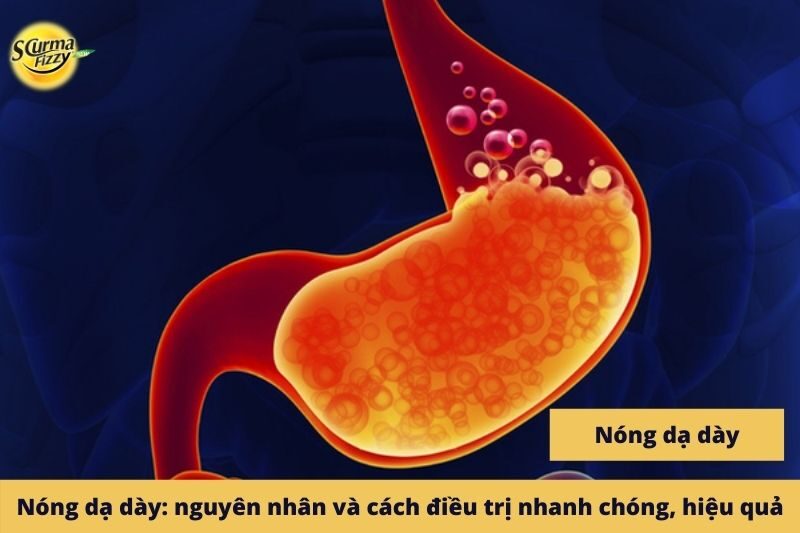 nong-da-day-nguyen-nhan-va-cach-dieu-tri-nhanh-chong-hieu-qua-anh-dai-dien