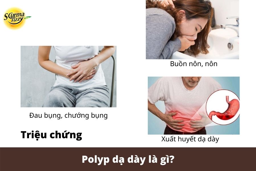 Polyp-da-day-la-gi-3