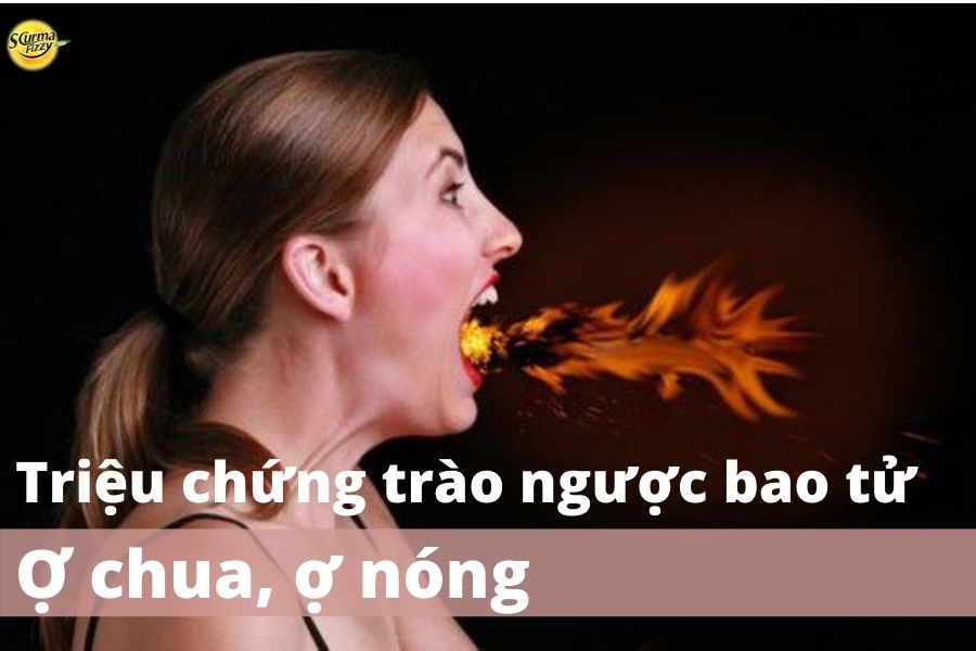 trào-ngược-bao-tử2