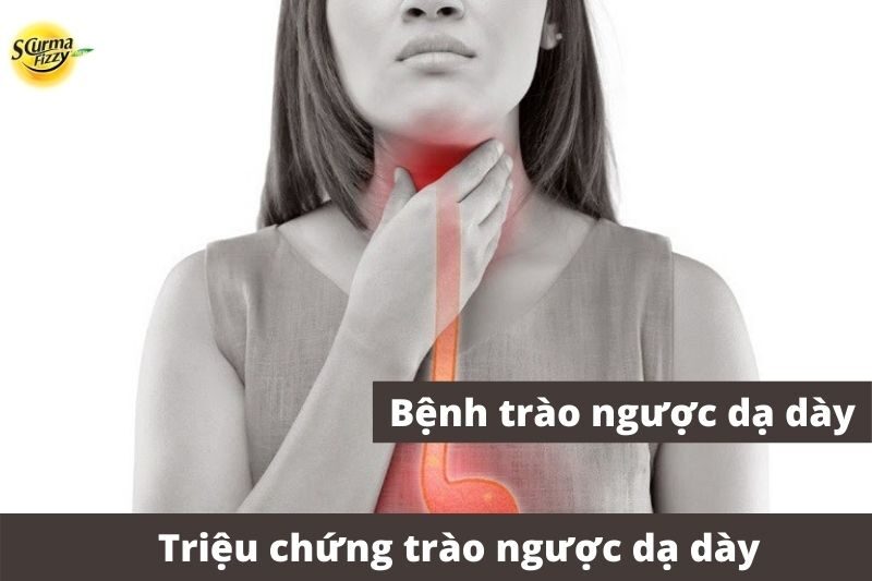 trieu-chung-trong-benh-trao-nguoc-da-day-anh-dai-dien