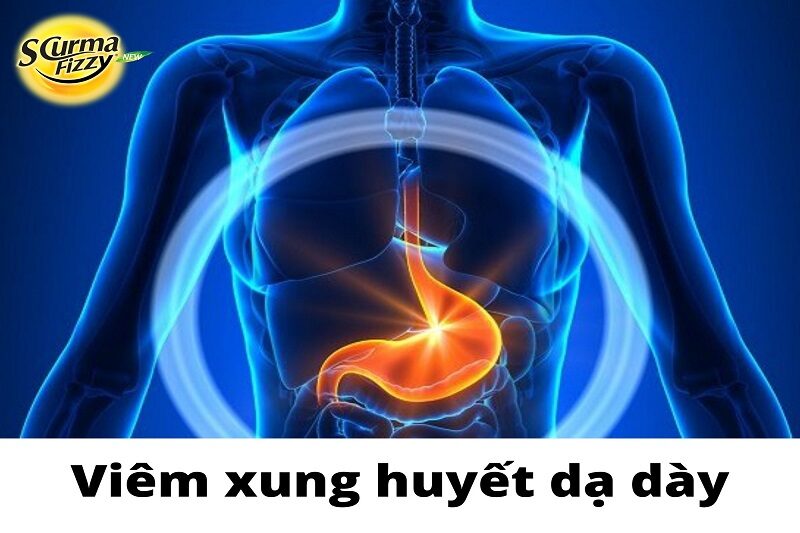 viem-xung-huyet-da-day- 5