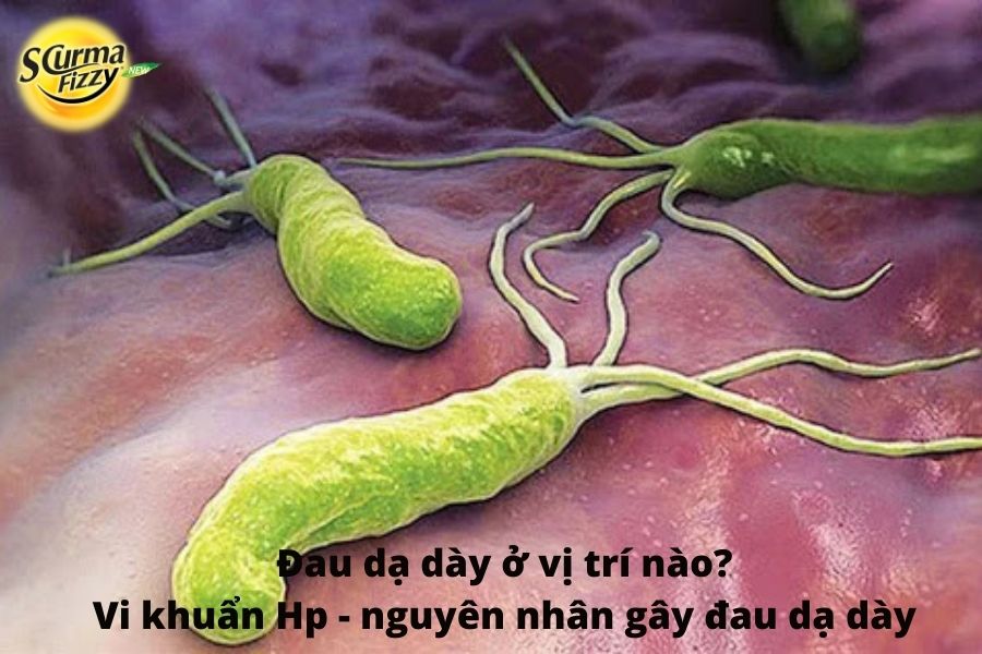 vi khuẩn Hp