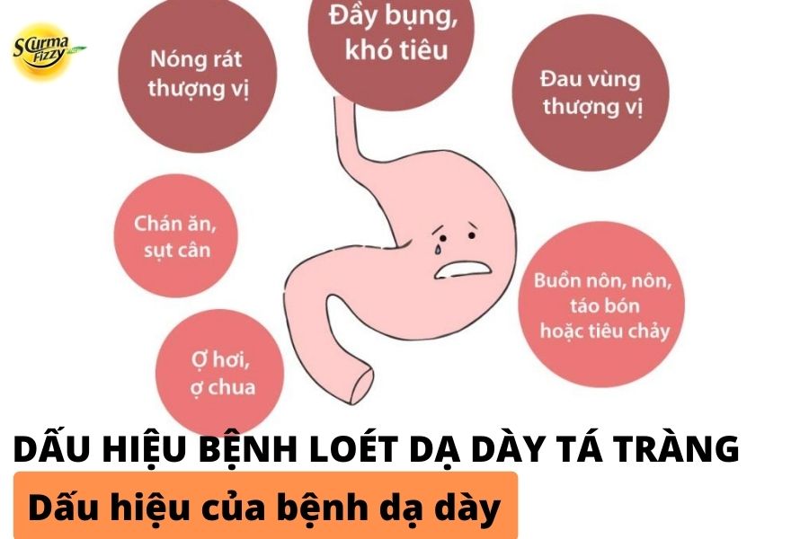 dau-hieu-cua-benh-da-day-2
