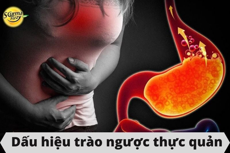 dấu hiệu trào ngược thực quản