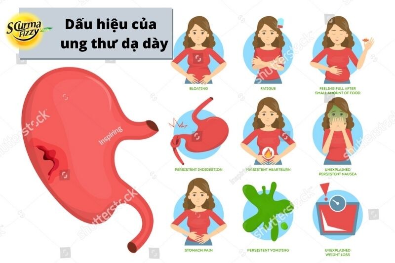 dau-hieu-cua-ung-thu-da-day