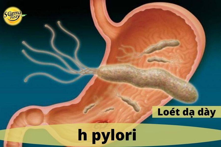 h- pylori-3