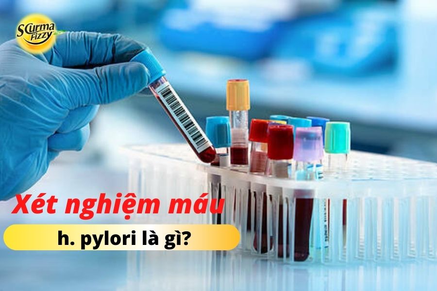 Xét nghiệm máu chẩn đoán nhiễm Hp
