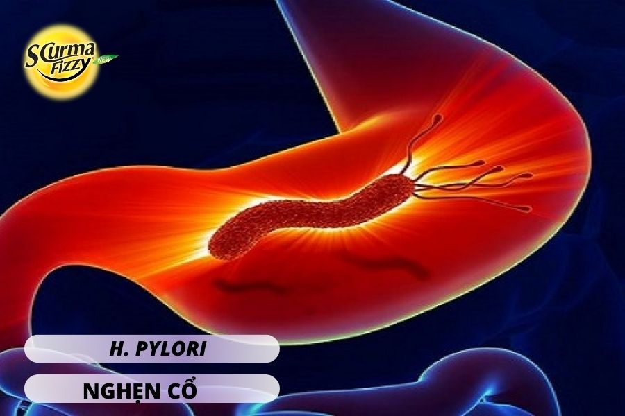 Helicobacter pylori (