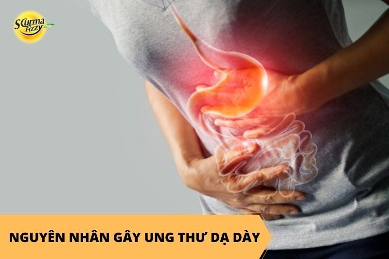 nguyen-nhan-gay-ung-thu-da-day