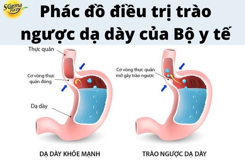 phac-do-dieu-tri-trao-nguoc-da-day-cua-bo-y-te