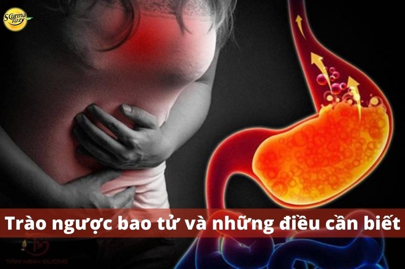 trào-ngược-bao-tử1