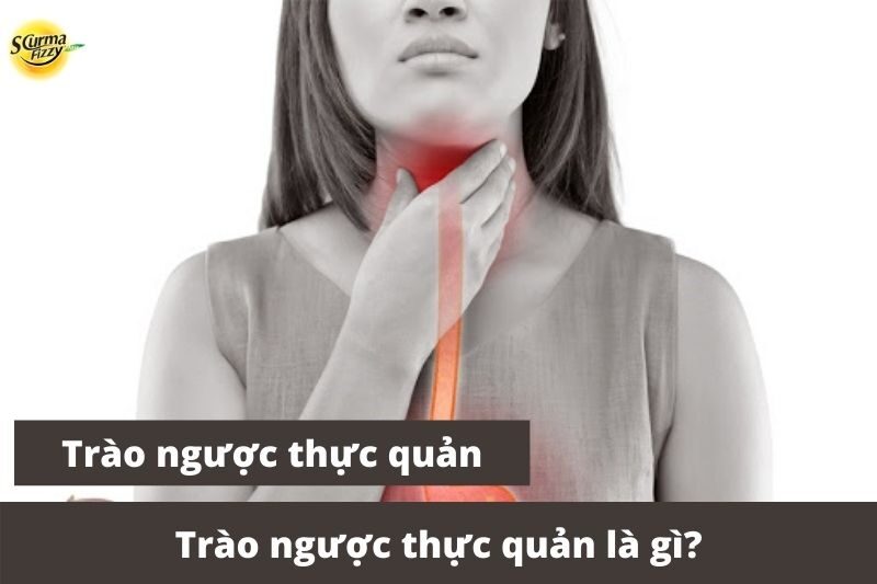trao-nguoc-thuc-quan-la-gi-anh-dai-dien