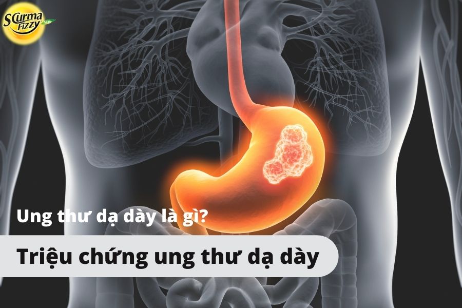 trieu-chung-ung-thu-da-day-1