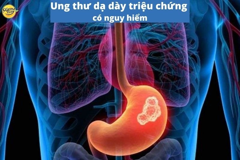 Ung thư dạ dày triệu chứng có nguy hiểm không