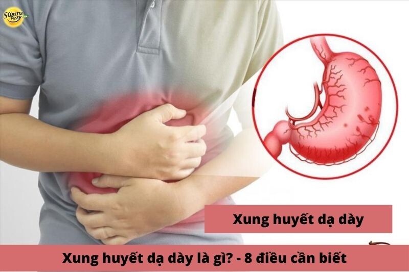 xung-huyet-da-day-la-gi-8-dieu-can-biet-anh-dai-dien
