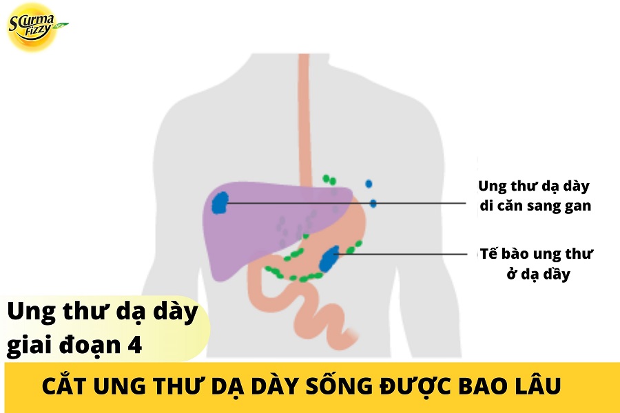 cat-ung-thu-da-day-song-duoc-bao-lau-10