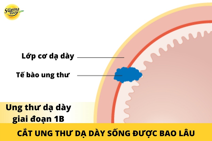 cat-ung-thu-da-day-song-duoc-bao-lau-4