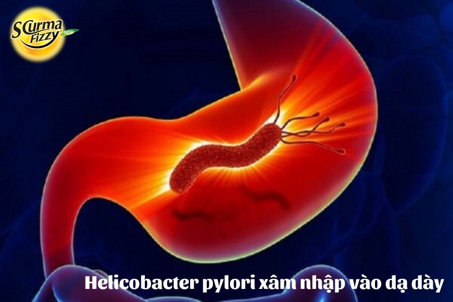 Helicobacter pylori xâm nhập dạ dày