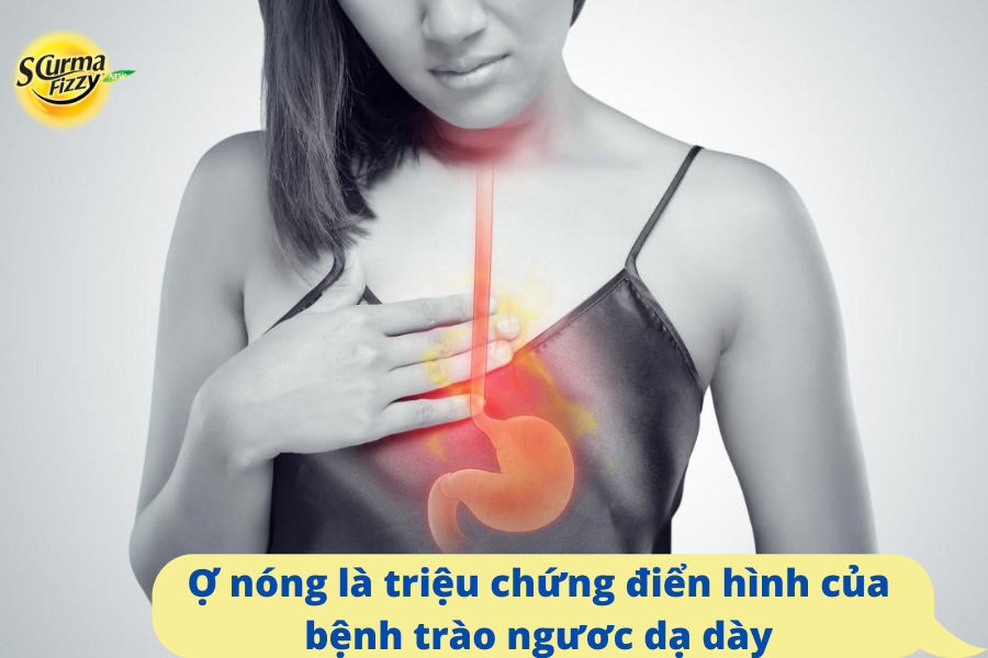 Ợ nóng là triệu chứng điển hình của bệnh trào ngươc dạ dày
