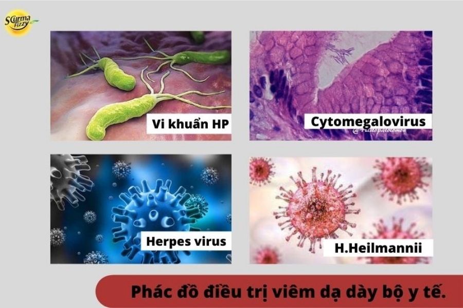 Một vài loại virus gây nhiễm trùng trong viêm dạ dày.