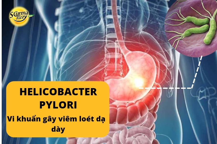 Helicobacter pylori-3