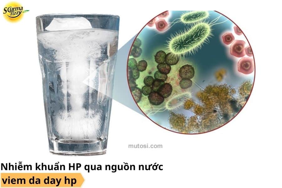Nhiễm khuẩn HP qua nguồn nước bẩn